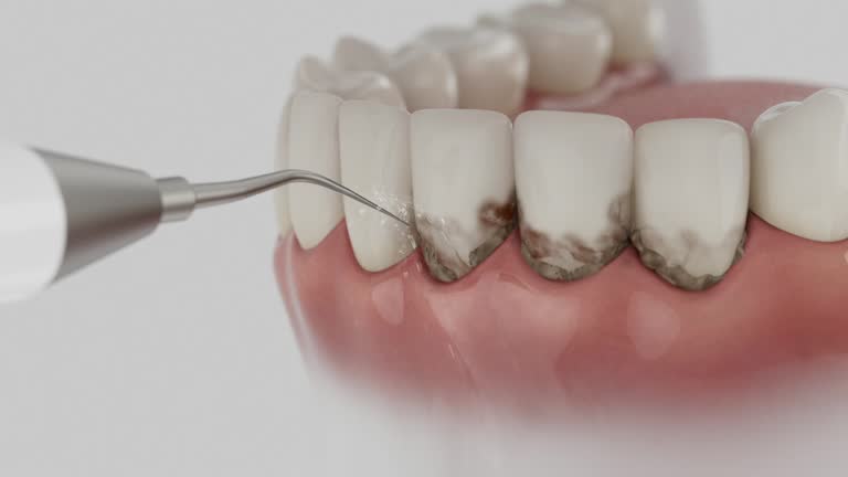 Trusted Dental Crowns And Bridges service in Grandview, TX - Dentist Open Now